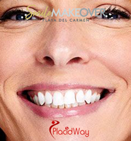 Slider image (2) Smile Makeover Playa Del Carmen